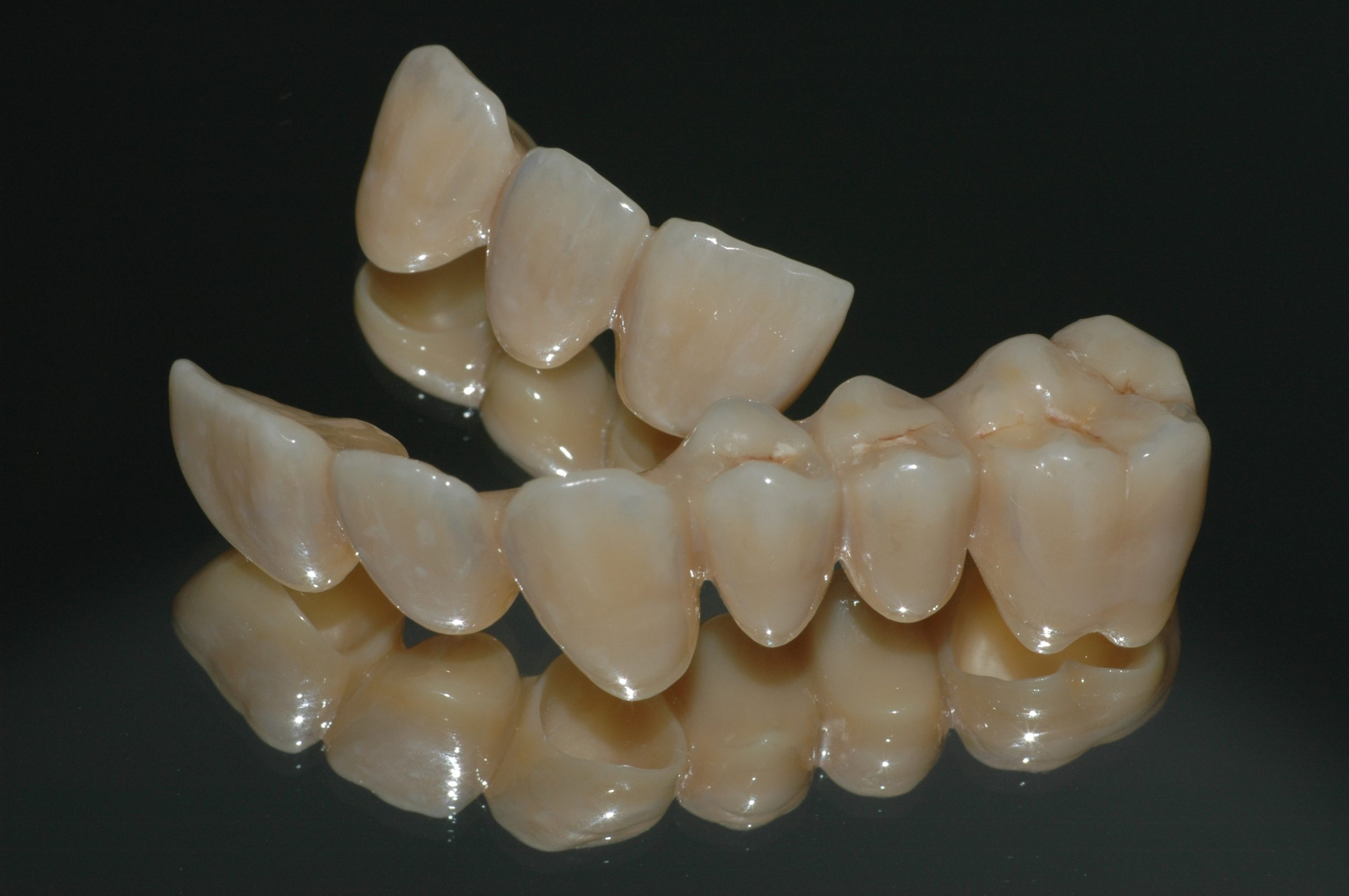 Protesi Dentali Forlì Dentista Studio Odontoiatrico